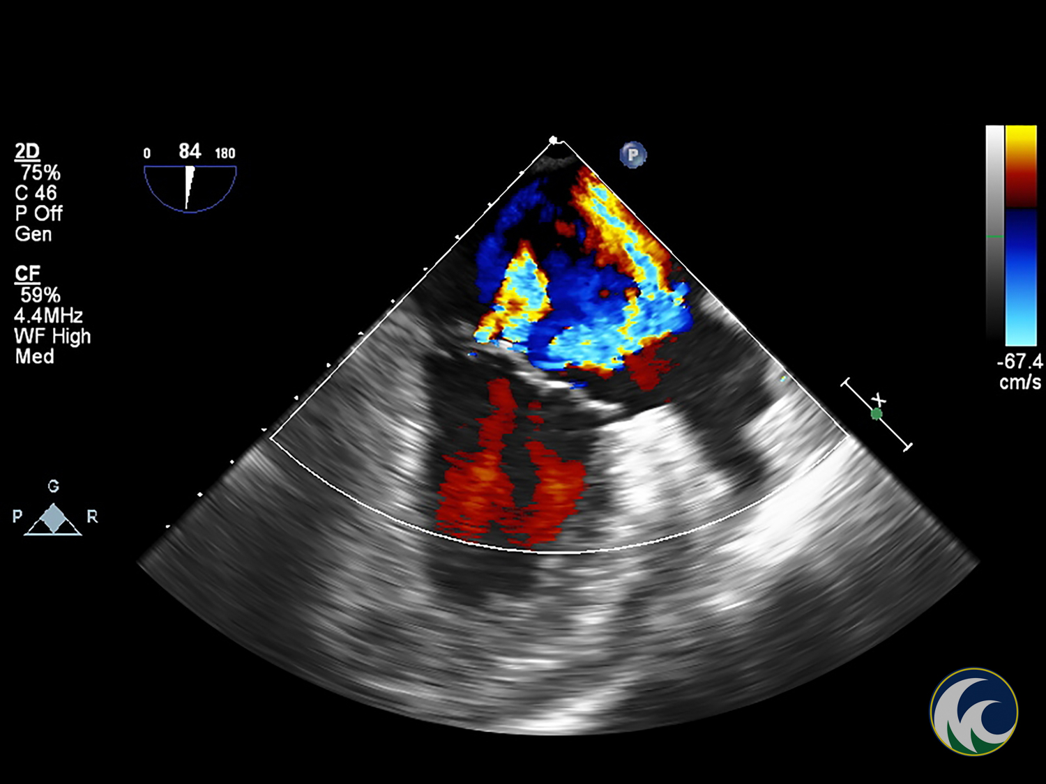 Sonography - Echocardiography - 2